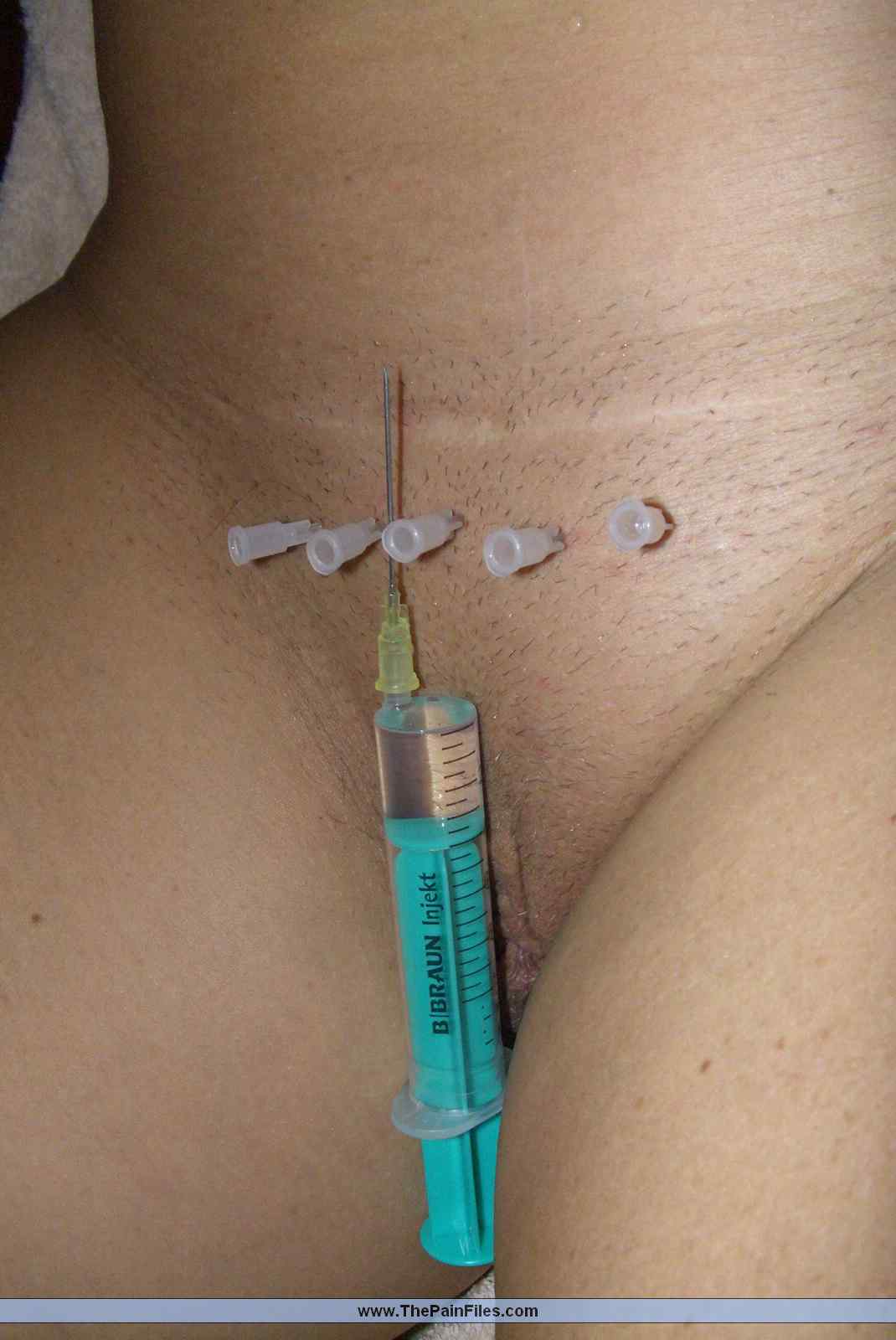 Porn needle pain 